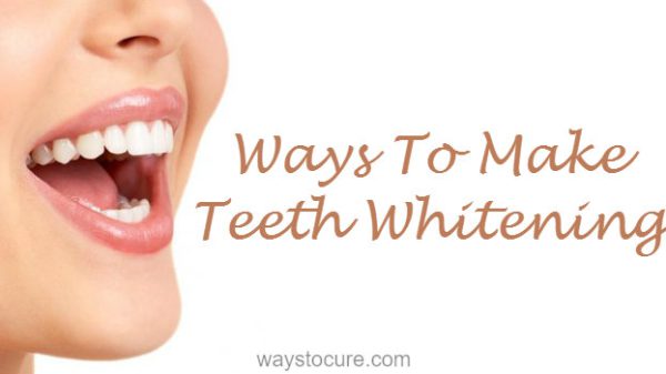 Ways-To-Make-Teeth-Whitening