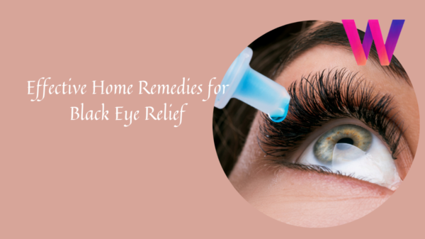 Effective Home Remedies for Black Eye Relief