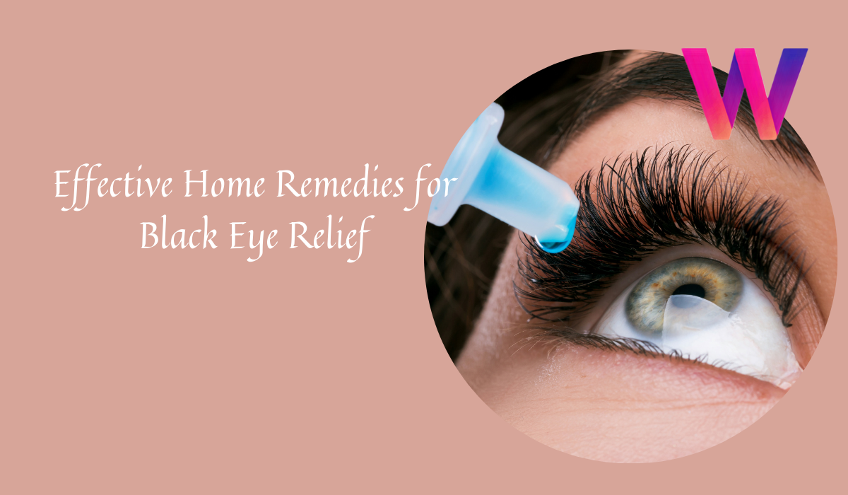 Effective Home Remedies for Black Eye Relief