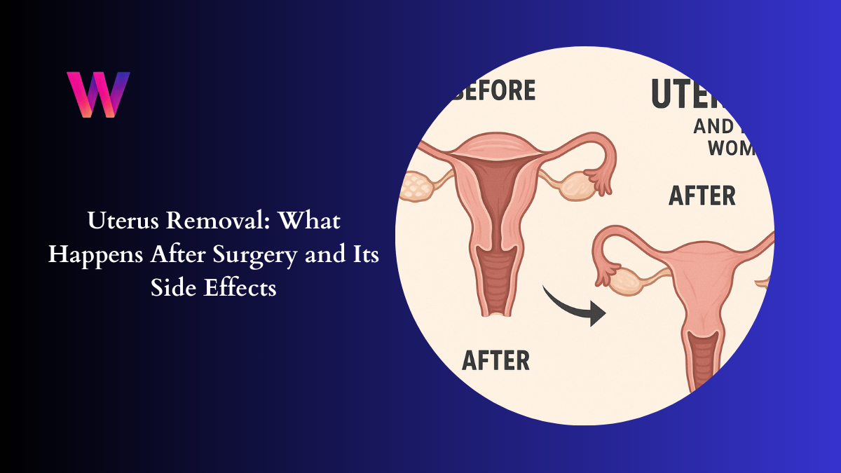 Uterus Removal What Happens After Surgery and Its Side Effects