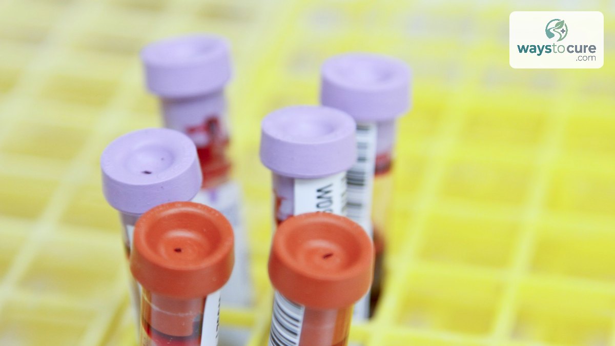 Blood samples in labelled test tubes ready for laboratory testing
